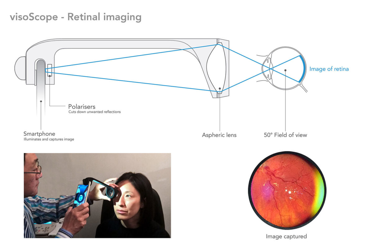 oDocs  visoClip & visoScope